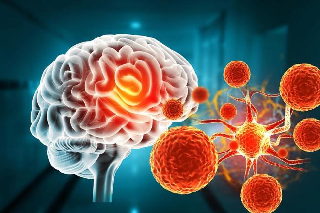 女子嘴角起泡未重视竟脑死亡 小泡背后的大隐患