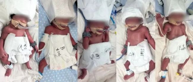 24岁女子成功诞下5胞胎 六千万分之一奇迹