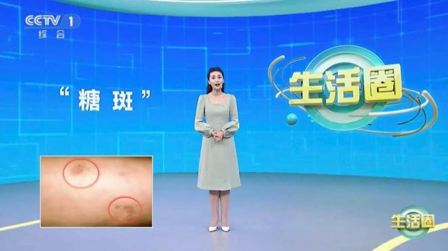 身体出现这5个变化要重视 科学控糖指南请查收