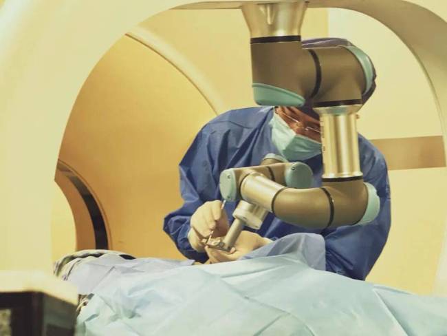 上海医生仅用35分钟一针消融病灶 机器人导航精准治疗