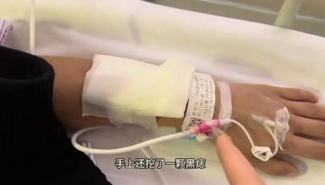 男子一周做完包皮痔疮智齿等5场手术 狠人老公遭罪经历引热议