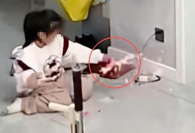 女孩玩拼豆烧伤 妈妈：这是隐形炸弹