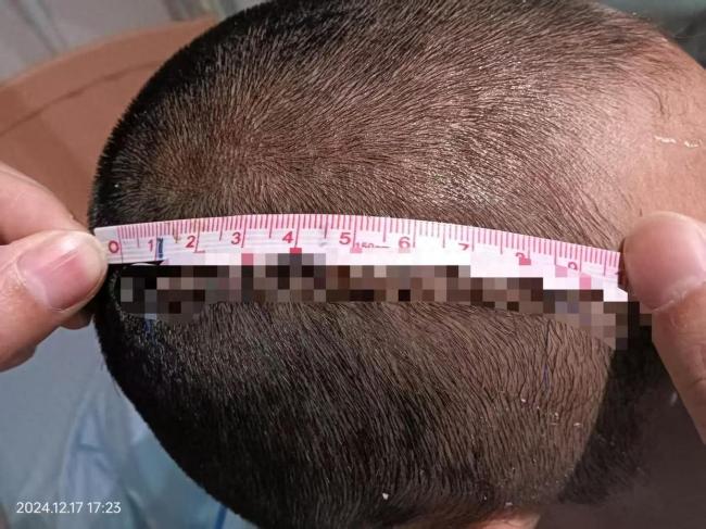 爷爷误会孙女被打砍伤其同学被判无期