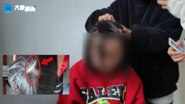 湖南姐弟遭继母生父刻毒细节曝光 狂暴活动令东谈主发指