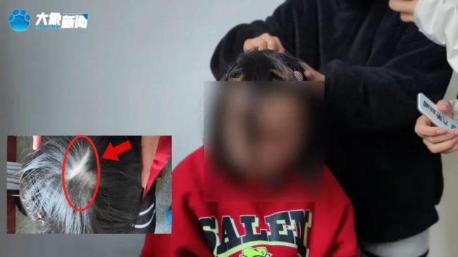 男孩遭继母虐待 求生母不要再婚 残忍虐待震惊社会