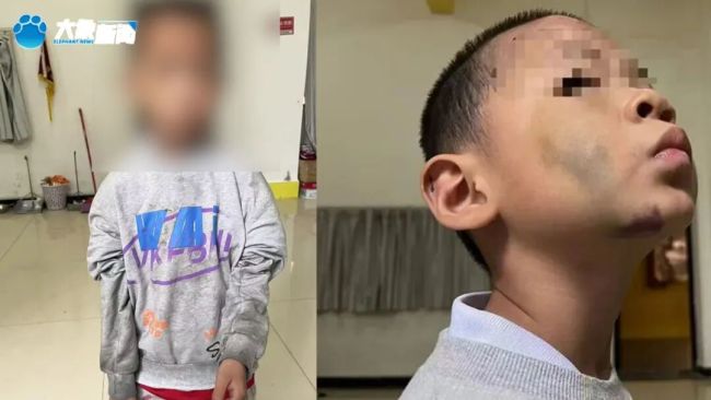 15岁姐姐目睹弟弟被继母虐待全程 生父继母的残忍行径