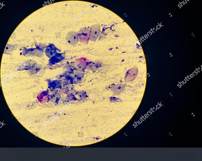 异体移植突破跨物种器官移植壁 医学革命带来新希望