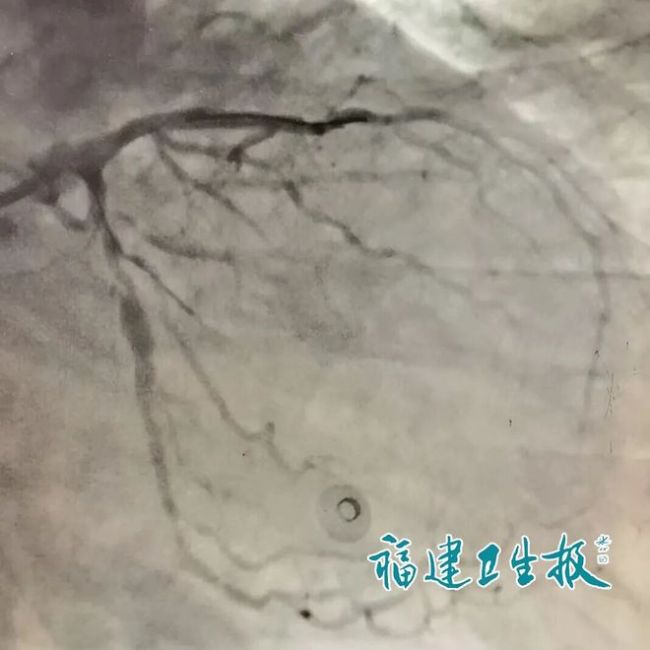七旬老人旅游途中心梗执意返乡 危急时刻医生苦劝两小时