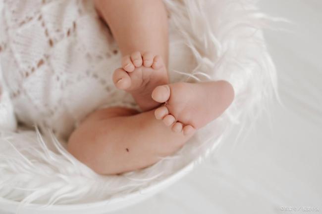 医院回应女婴刚出生一天没有肛门