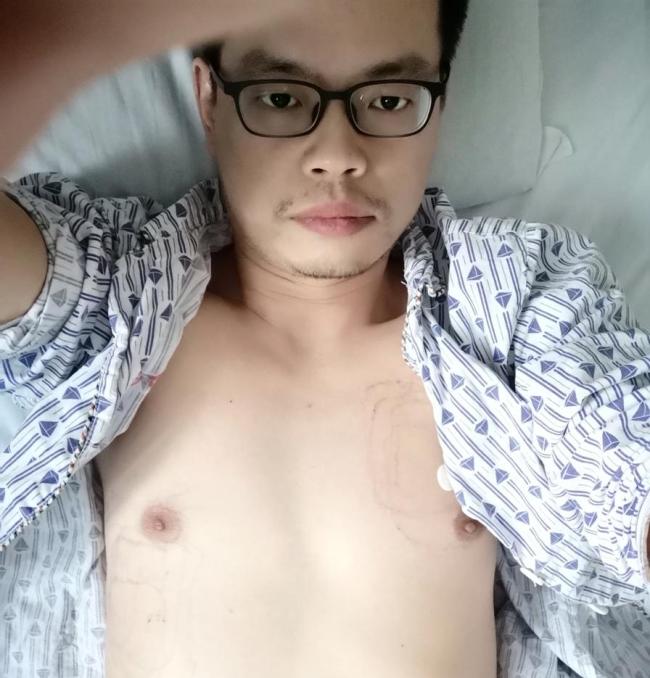 40岁心梗幸存者已辞职回农村静养 重生后的平静生活