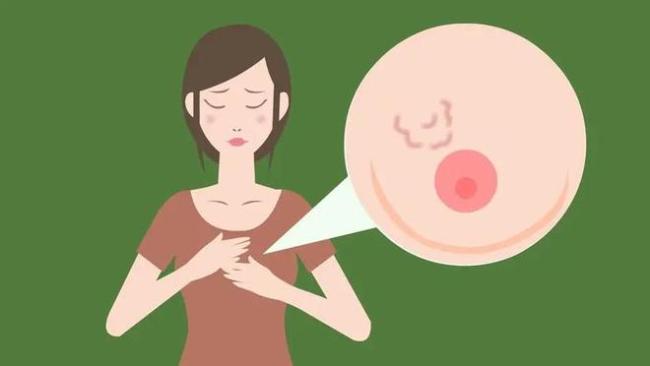 乳腺结节有3个特征更易癌变 科学应酬别慌