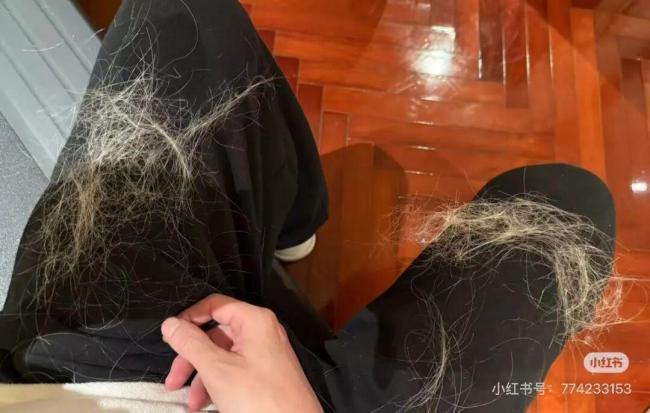 薛之谦自曝因染发导致斑秃 硬挺一周不洗头