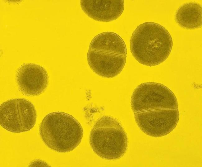 细菌超标！电饭煲“保温”不要超4小时 警惕健康隐患