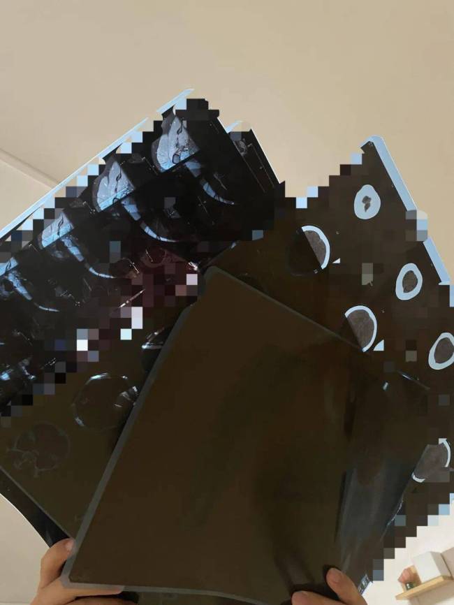 1.5元收一张旧CT片？千万别卖 非法提炼污染环境