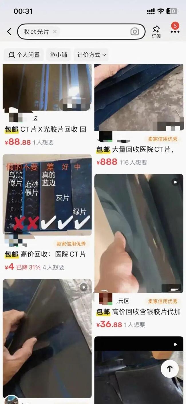 1.5元收一张1CT片?千万别卖 非法提炼污染环境