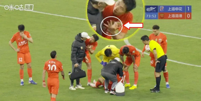 媒体：部分中超球队滥用脑震荡换人 规则漏洞成战术