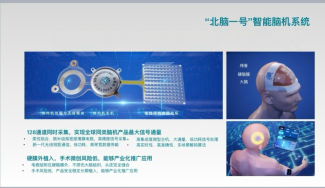 “北脑一号”脑机接口进入临床研究 助力高位截瘫患者康复