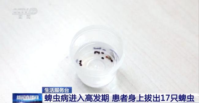 不慎被蜱虫叮咬千万别“硬拔” 正确处理方法很重要