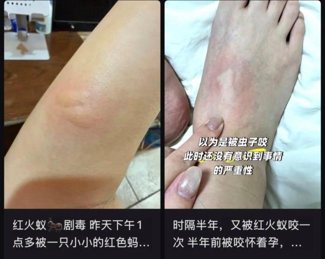 遇到这种小土包千万别踩 曾有人丧命 红火蚁巢穴危险重重