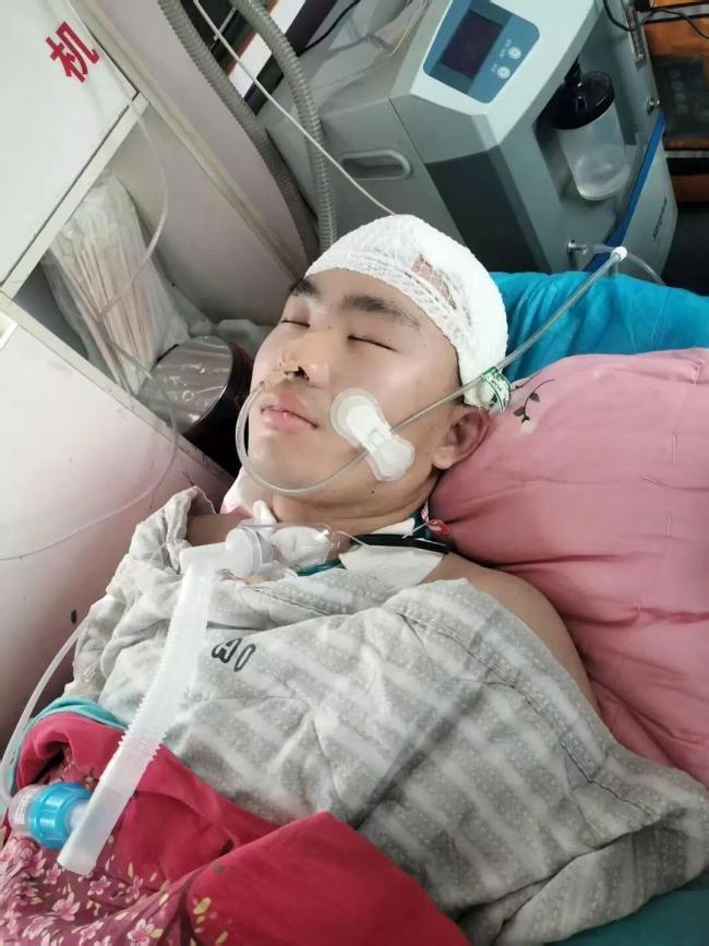 肇事方回应23岁研究生被撞颅脑损伤 两个家庭的悲剧