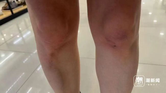 护士2分钟心肺复苏救回骑手 专业急救显身手