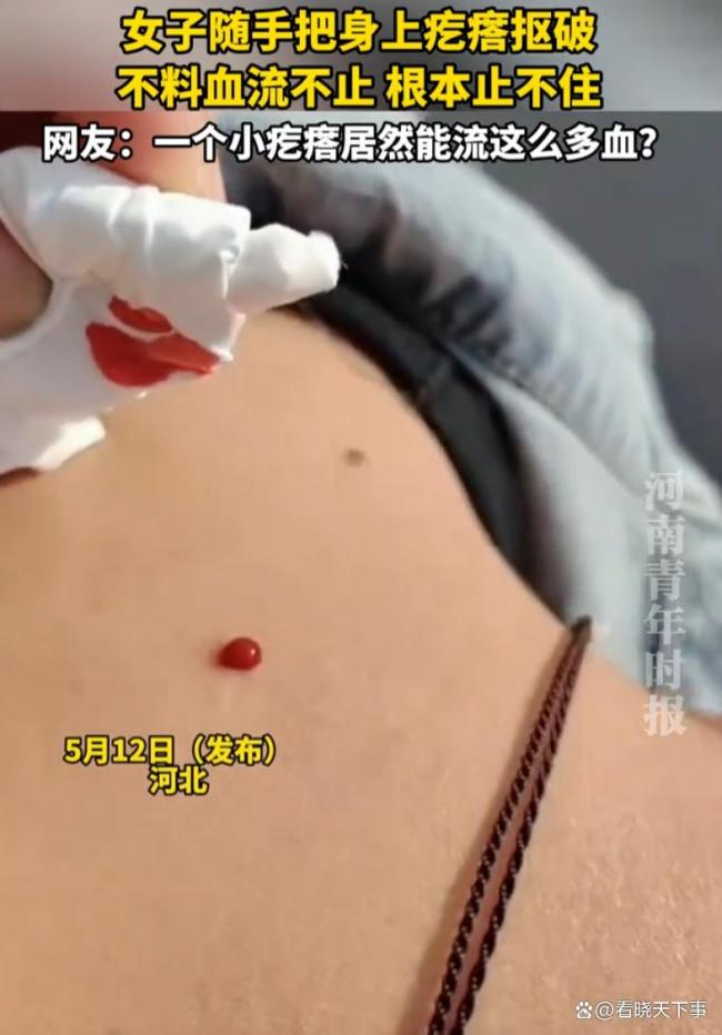 女子随手把身上疙瘩抠破血流不止