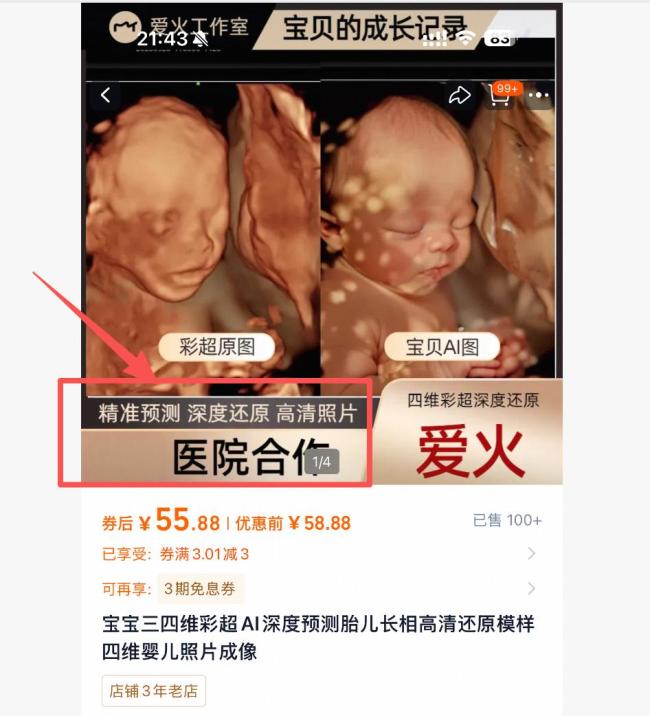AI预测胎儿长相成生意 商家牟利暗藏风险