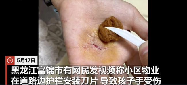 小区护栏刀片割伤男孩 物业态度嚣张 物业责任与良知何在