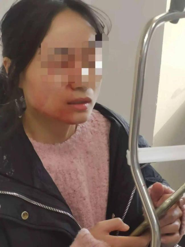 教师劝架被戳伤眼球涉事学生家长回应 家长表达歉意并愿担责