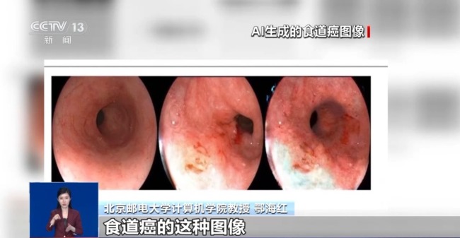 畢業(yè)論文將檢測AIGC率 今后該如何界定使用邊界？