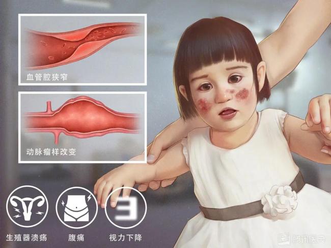 11歲男孩反復(fù)潰瘍兩年后查出心臟病 警惕隱藏的健康危機(jī)