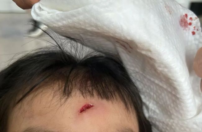 女童與機(jī)器狗互動(dòng)面部被撞 安全提示缺失引發(fā)關(guān)注
