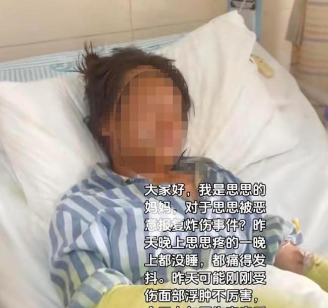 女主播遭快遞盒爆炸燒傷案更多細(xì)節(jié) 嫌犯多次精心策劃作案