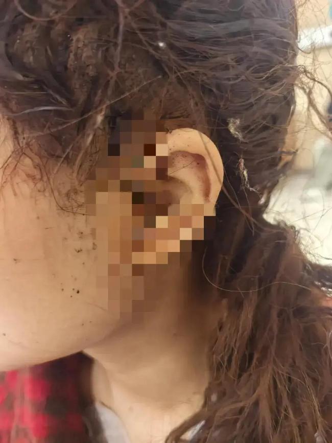 捅傷閨蜜后自殺身亡女生患抑郁 悲劇背后的心理陰影