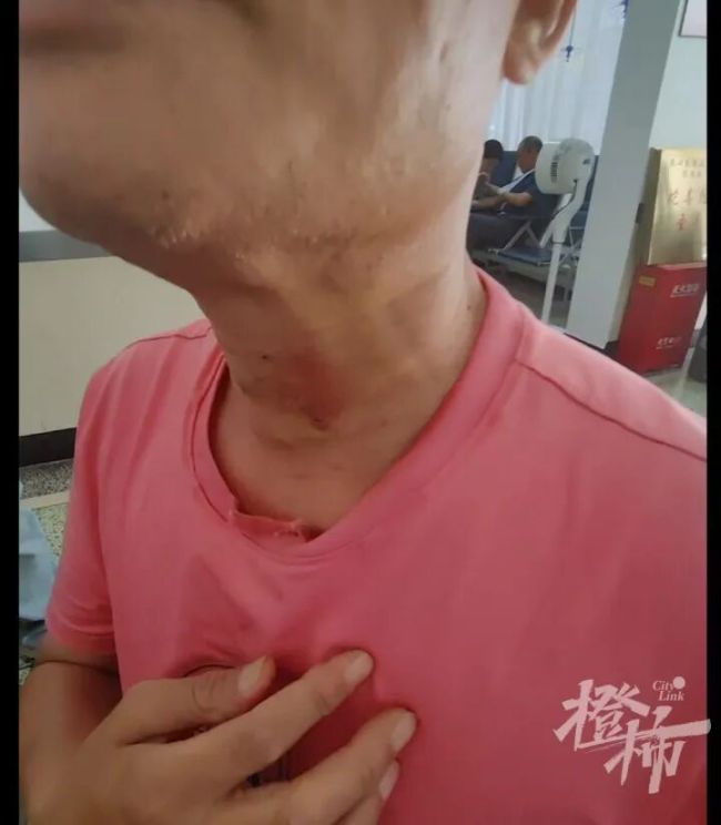 男子放生大蛇反遭锁喉撕咬 现代版农夫与蛇
