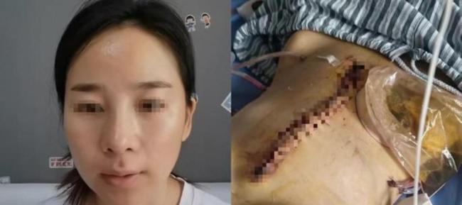 遭16次家暴小谢捐赠物资运抵横州 爱心满满送温暖