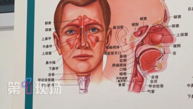 广东9岁女孩因抠鼻孔险些毁容 小动作暗藏大危机