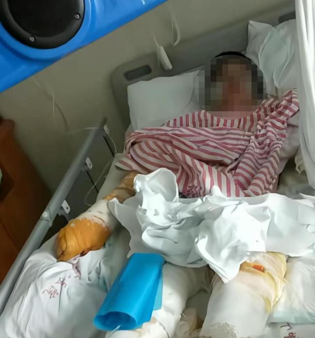 泼硫酸男子被执死刑受害人发声 正义已到,生活仍难
