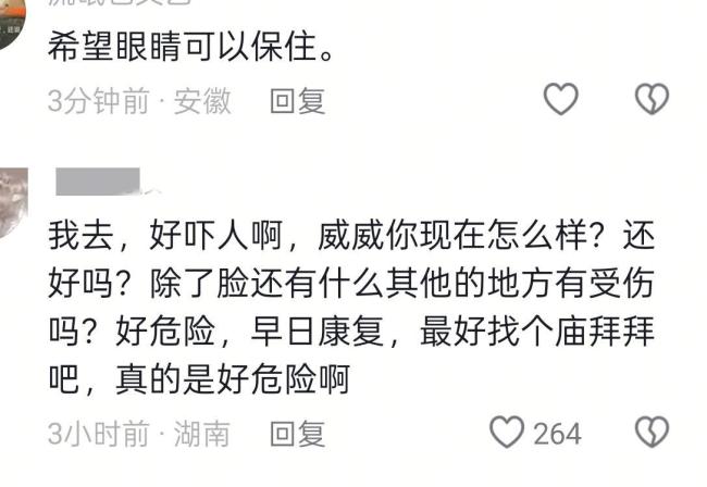 演员陈威翰遇到严重车祸左脸受伤 左眼失明风险引担忧