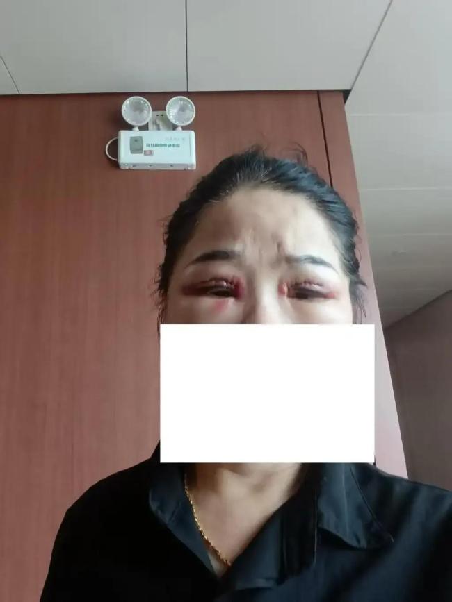 卫健部门回应保洁阿姨整形后患眼疾