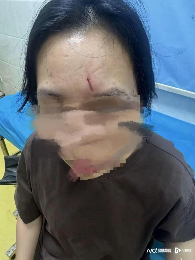 教练失手女子被踏板砸中:当场砸出血