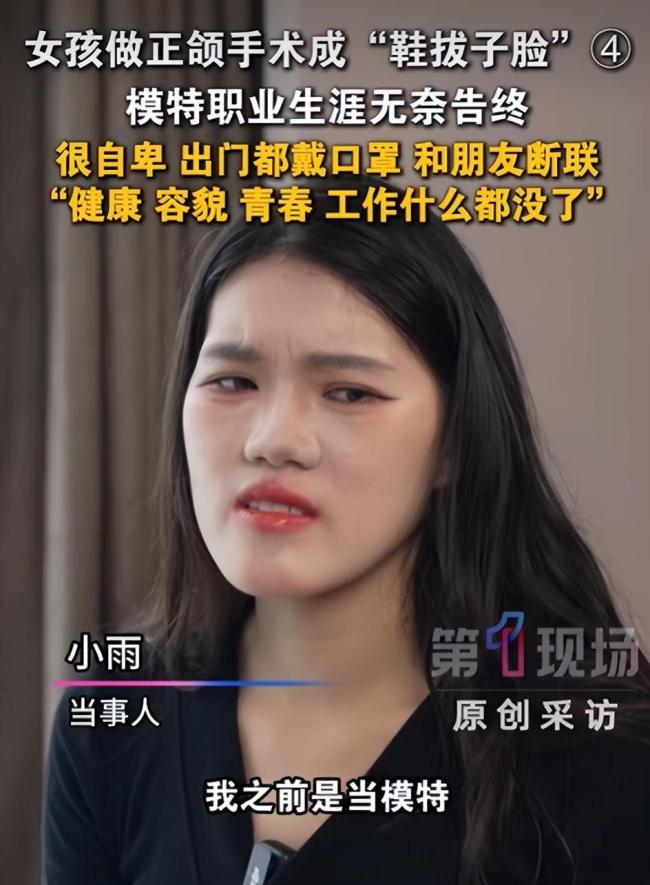 正颌手术被做反女孩:已达成和解,希望回归正常生活