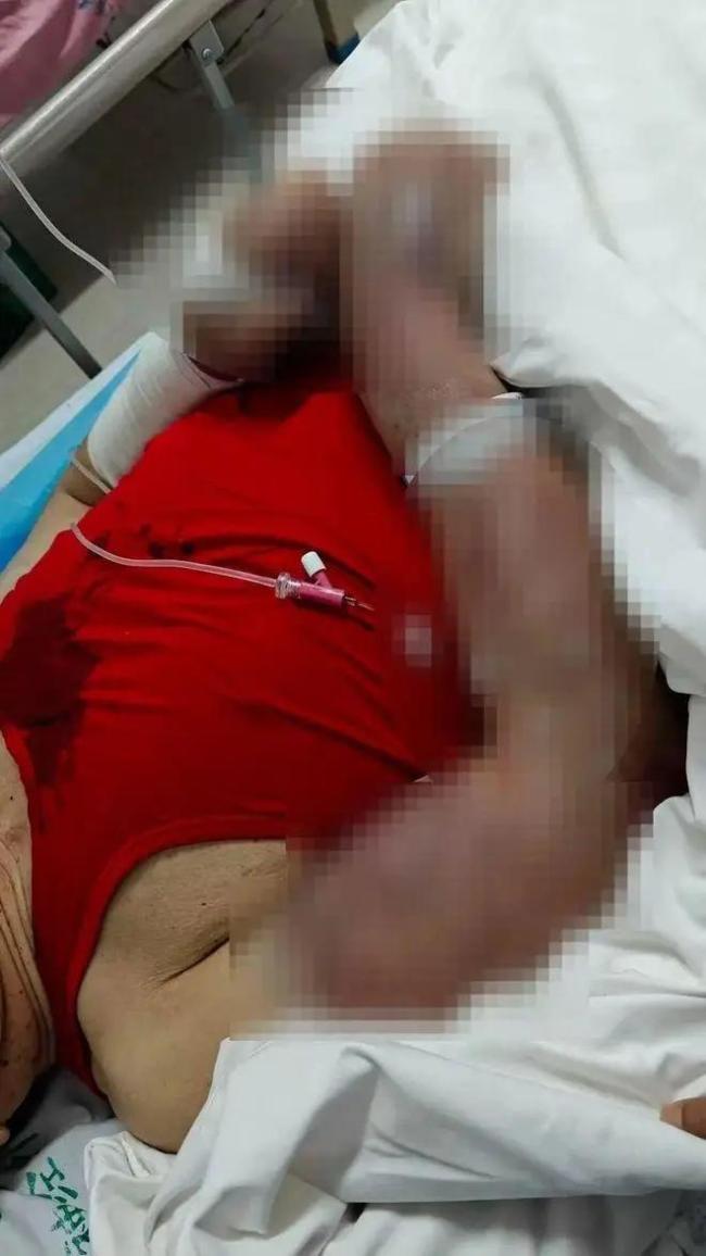 高龄老人疑遭智力低下老人殴打