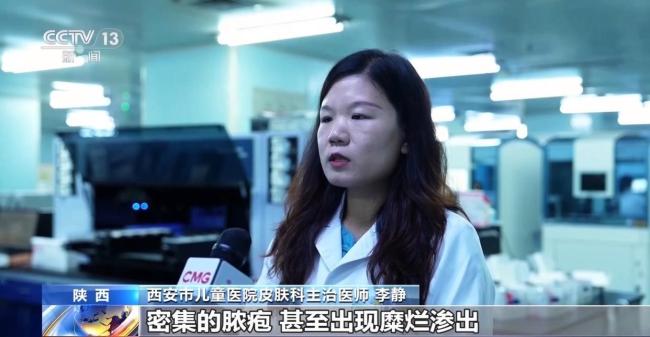 遇到隐翅虫切勿拍打