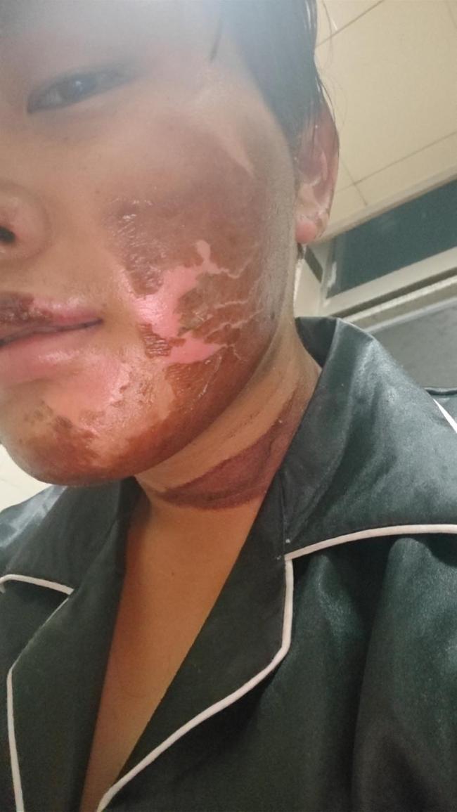 外卖小哥送餐时救火 车辆复燃爆炸 英勇行为获表彰