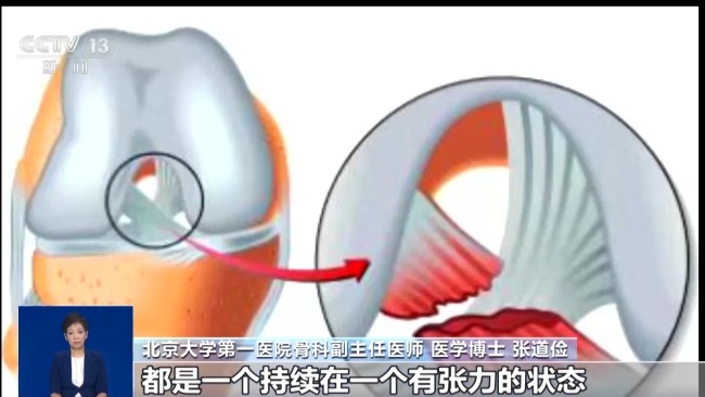 “闪身步”爆火 盲目模仿或有损健康 专业动作需谨慎