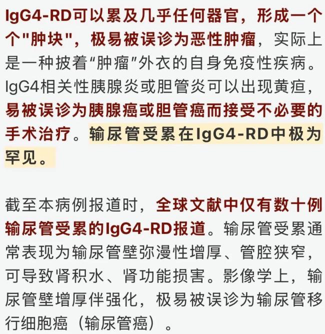 老人痴迷保健品全身多处异常肿大 最终确诊IgG4相关疾病