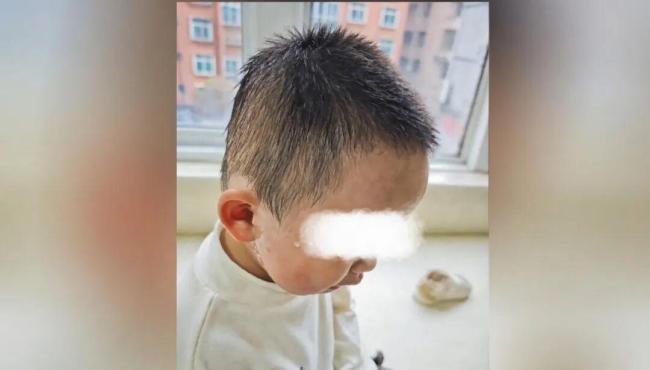 男童误食洗衣凝珠,嘴巴冒泡泡 母急救送医化险为夷