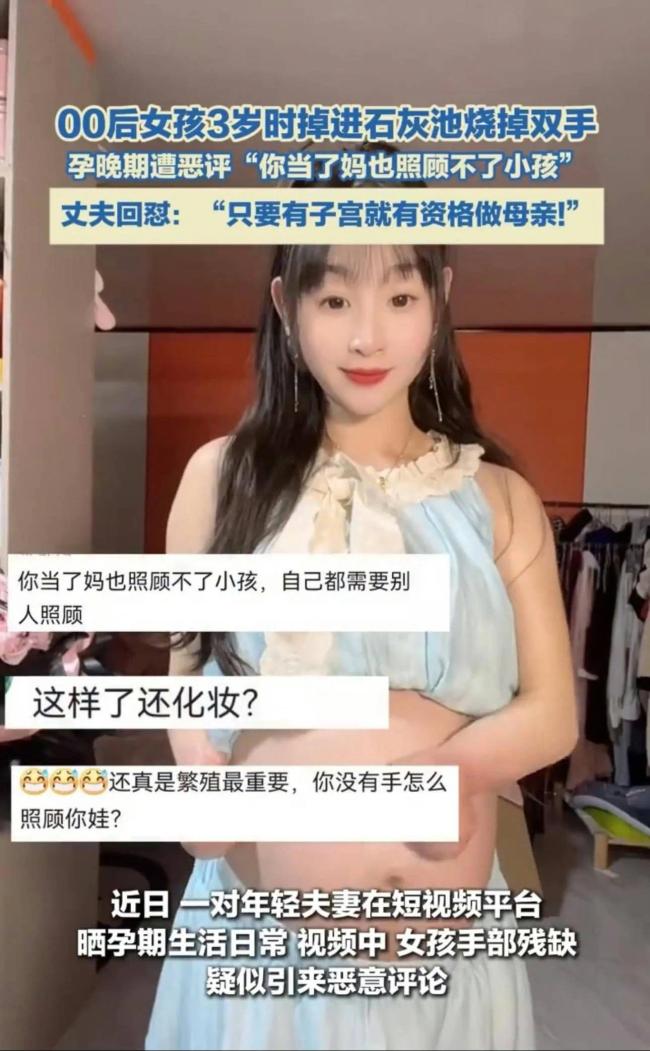 女子3岁烧掉双手现孕珠9个月遭质疑 丈夫回怼恶评