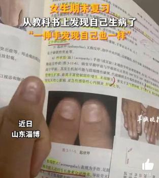 女生发现自己指甲跟课本病例图片一样